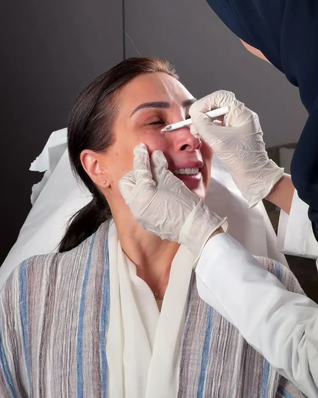 إجراء تجميلي